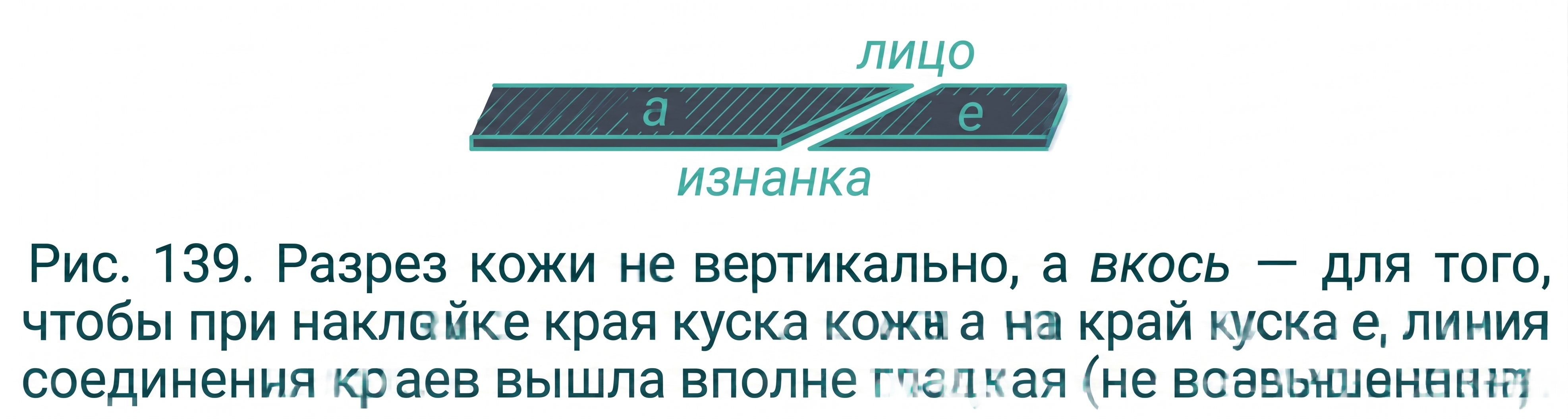 Разрез кожи вкось